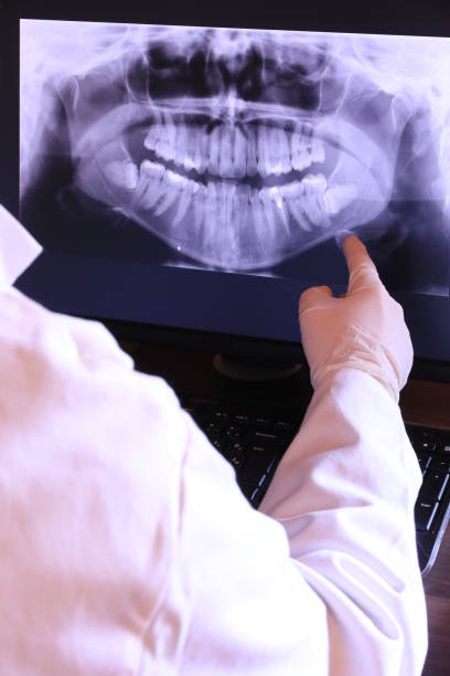 Best Emergency Dental Extractions in Wesley Chapel, FL