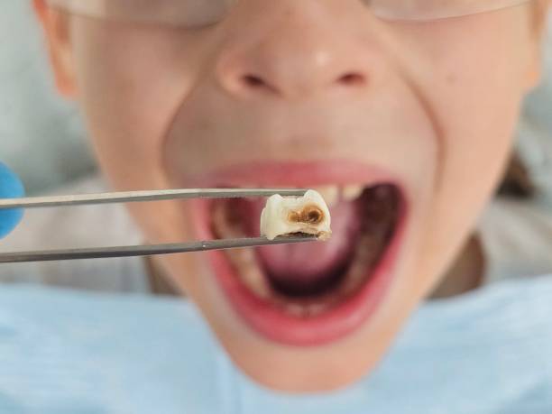 Best Emergency Dental Services for Seniors in Wesley Chapel, FL
